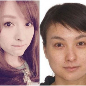 “想要无“痘”容颜，就用慧蜜儿祛痘精华！