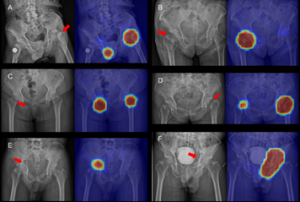 平安科技10篇论文入选美国顶级年会，技术探索和应用切中前沿