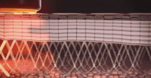 北京美天整形张潘院长：热玛吉抗衰除皱疼吗，安全吗？