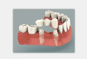 杭州牙科医院举办第五届种植手术直播暨种植团队分享会
