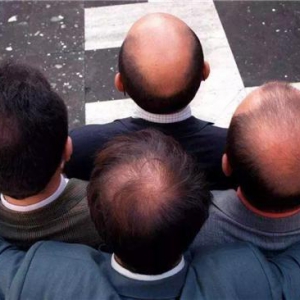 2020年“头发经济”如何演进？头部品牌黑奥秘说出了真相！