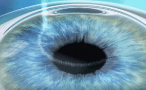 2020年度一年两次征兵合并，近视参军需提早半年做准备！