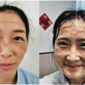 拯救口罩脸，逆行路上的“橡皮擦”，克奥妮斯在行动！