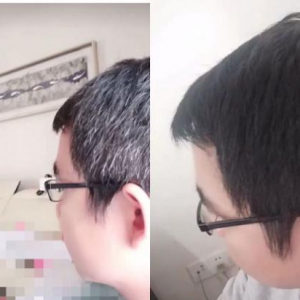 妙手治白发，贾医师究竟有何妙招