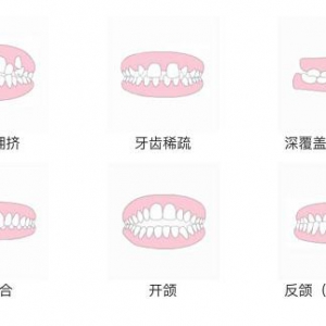 是时候解除你对牙齿隐形正畸的那些误会了