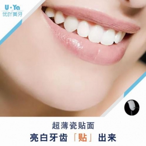 优吖美牙—专注口腔美学，还你自信笑容—美白牙齿