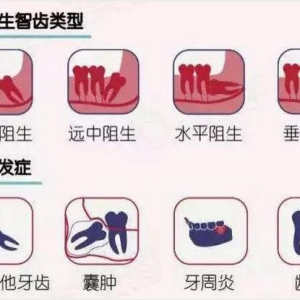 这能忍？智齿反复“作妖”终于要对它下手了