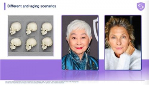 俊泰美好薛志强博士出席欣可丽全球医美峰会并发表演讲：重新定义“新生抗衰”