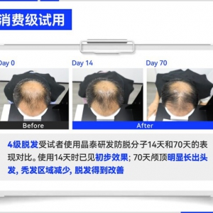 晶泰科技AI破局生发难题，"双子星"新分子联用引领突破性效果